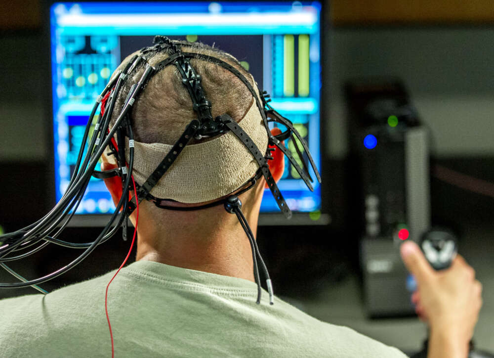 Hensing 2025 neurotech E Uand DEU OJ
